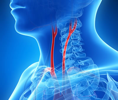 Visual of carotid arteries inside the human neck