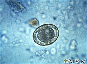 Roundworm eggs - ascariasis