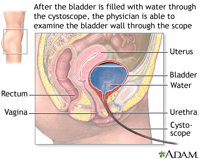 Anatomy of the Bladder  Saint Luke's Health System