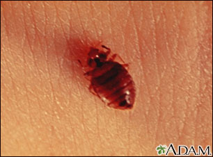 Bedbug - close-up