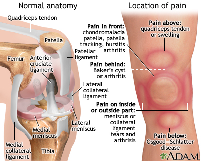 knee pain injury ligament causes collateral tendon arthritis symptoms front joint after leg wearing multimedia anterior location patella cause slideshow